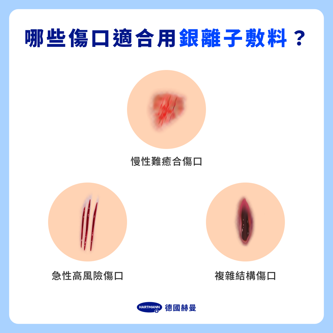 哪些傷口適合用銀離子敷料？